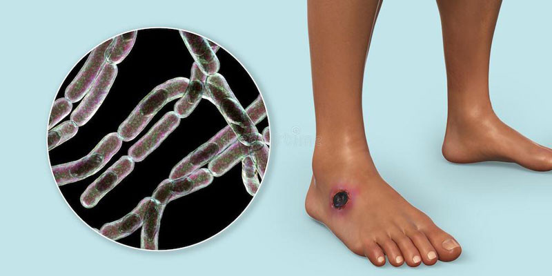 Xác tuần lộc chết sẽ giải phóng bào tử bệnh than, có thể kích hoạt trở lại thành Bacillus anthracis truyền nhiễm trong những trường hợp thích hợp. Mặc dù đây là vi khuẩn chứ không phải vi rút nhưng nó vẫn là lời cảnh báo đối với con người. Ảnh WHO