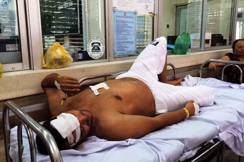 Nạn nhân Rachid đang điều trị tại BV Chợ Rẫy, TP HCM.