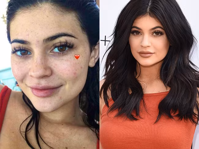 Khuôn mặt của Kylie Jenner lúc trang điểm và khi để mộc khác nhau một trời một vực.