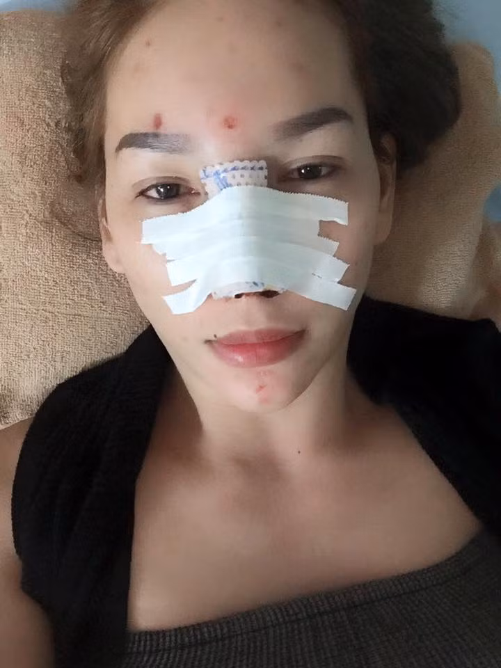 Theo Hoàng My, quyết định sửa mũi không chỉ làm hài lòng về khuôn mặt hơn mà đây còn được xem là một cách để cô tự làm mới mình, có thêm tự tin trong công việc và cuộc sống.