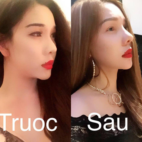 Quả thật, xem những bức ảnh mới của Hoàng My, có thể thấy tuy chiếc mũi của cô đã cao hơn đáng kể nhưng nhìn tổng thể khuôn mặt đã mất đi sự tự nhiên. Khuôn mặt cô người mẫu chuyển giới nay nhìn khá cứng, thậm chí là hơi... giả.