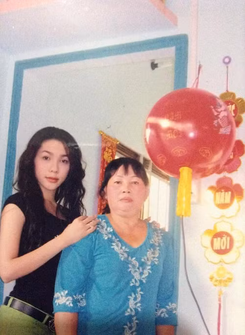 Dù đã có khuôn mặt khá xinh nhưng Hoàng My vẫn cho rằng chiếc mũi của mình "có vấn đề" nên đã nhờ đến dao kéo để làm mũi S-line. Nàng người mẫu chuyển giới còn không ngại công khai những hình ảnh trong quá trình sửa mũi nhiều đau đớn.