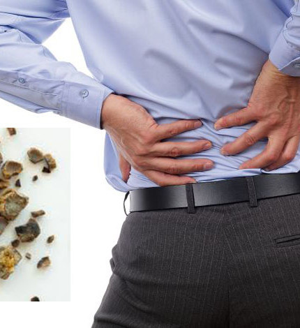 Bài thuốc 2: Nướng quả dứa trên lửa cho cháy vỏ ngoài rồi ép lấy nước trộn với 1 quả trứng gà đánh nhuyễn, uống 1 lần. Bạn chỉ cần uống liền 3 ngày và 2 lần/1 ngày sẽ thấy ngay hiệu quả.