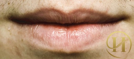 Môi tái xanh có thể do bạn bị khó thở hoặc chuẩn bị lên cơn hen suyễn.