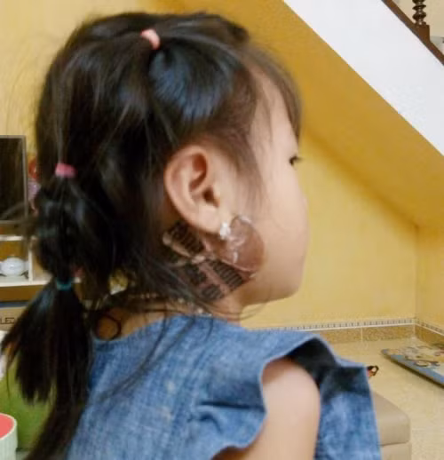 Bên cạnh thuốc uống thì bạn cũng có thể kết hợp với một vài bài thuốc bôi ngoài chữa quai bị.