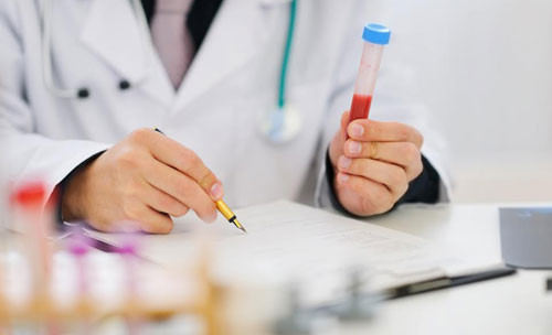 Nếu nghi ngờ môi trường sống và thực phẩm bạn đang sử dụng có nguy cơ nhiễm độc chì bạn có thể sử dụng những cách giải độc chì bằng thực phẩm tự nhiên dưới đây. Ảnh: Getty.