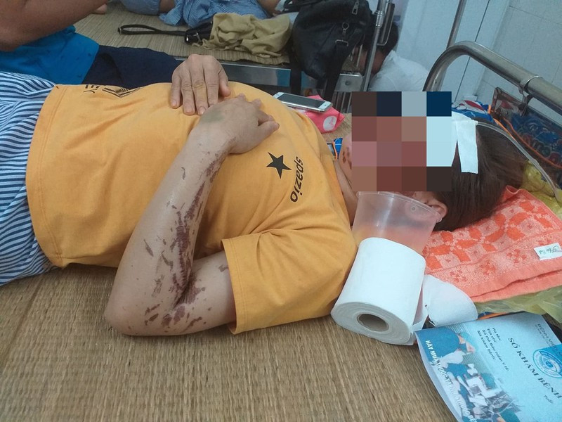 Ngày 30/8, Cảnh gọi điện thoại cho Phòng CSHS Công an tỉnh Hòa Bình xin đầu thú sau 13 ngày lẩn trốn ở quê. Đối tượng này bị truy nã với miêu tả cao khoảng 1,65 m, nặng trên 50 kg, tay phải có hình xăm; sau khi gây án đã bỏ chạy theo hướng quốc lộ 6, bỏ lại chiếc áo phông màu xanh đen tại hiện trường.