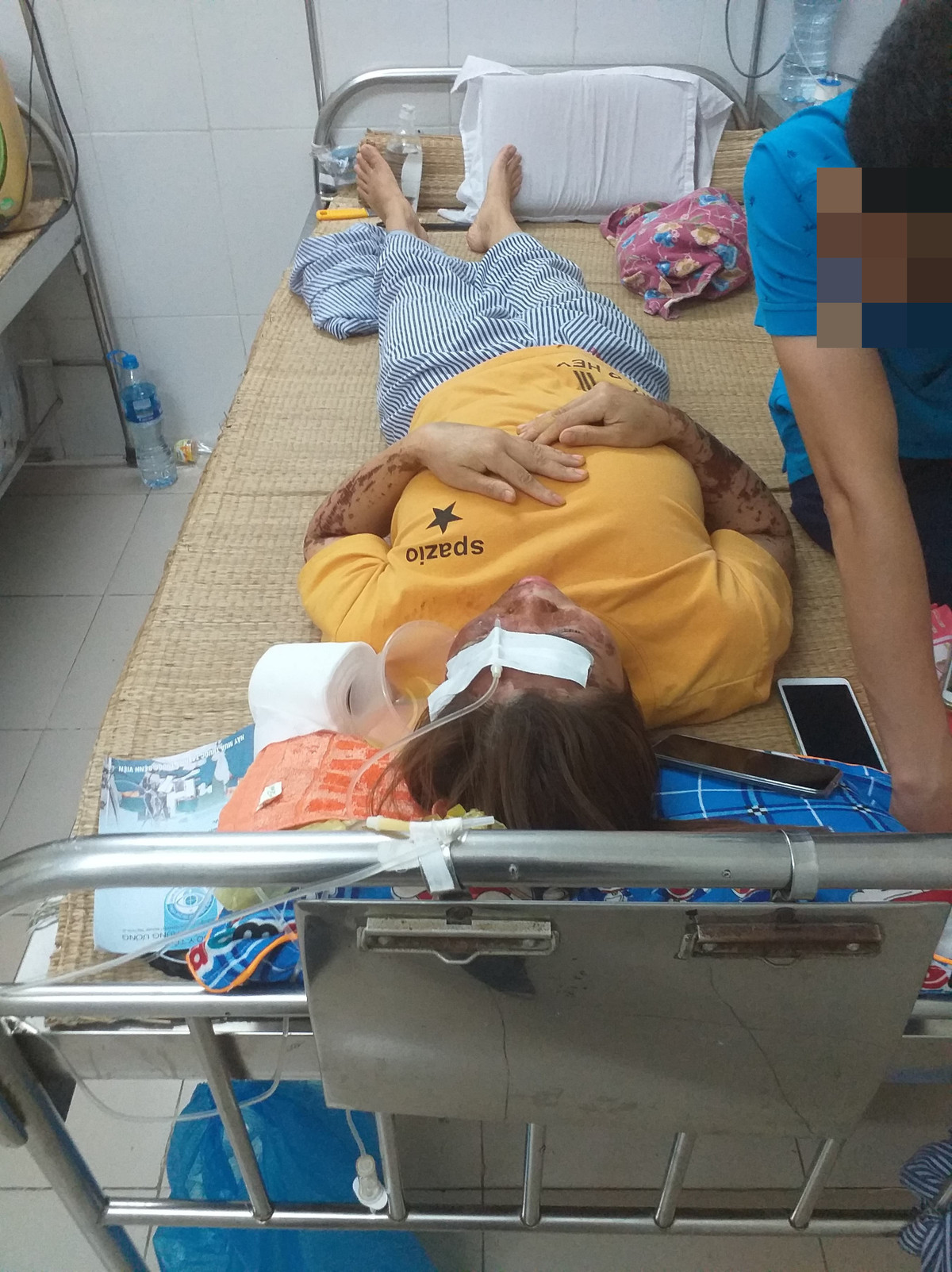 Trước đó như Kiến Thức đã đưa tin, sự việc xảy ra và khoảng 21h ngày 18/8, chị Bùi Thị Nhâm là nhân viên phụ bếp của trạm dừng nghỉ Như Ngọc 358 (thuộc địa phận Phố Bằng, xã Tây Phong, huyện Cao Phong, tỉnh Hòa Bình) bị một đối tượng nam giới dùng cốc sứ đựng axit tạt vào vùng mặt.