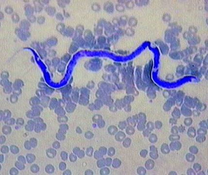 Dirofilaria immitis. Dirofilaria immitis là một trong những bệnh đe dọa tính mạng con người nghiêm trọng gây ra bởi giun tròn và muỗi. Các vết cắn của muỗi có chứa ấu trùng của giun tròn này là lý do thực sự lây lan của căn bệnh này. Bạn nên tránh việc giữ vật nuôi như chó, mèo và con vẹt ở nhà vì muỗi dựa vào các loài động vật này để lấy thức ăn. Căn bệnh này phổ biến ở Canada và Mỹ.