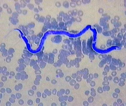Dirofilaria immitis. Dirofilaria immitis là một trong những bệnh đe dọa tính mạng con người nghiêm trọng gây ra bởi giun tròn và muỗi. Các vết cắn của muỗi có chứa ấu trùng của giun tròn này là lý do thực sự lây lan của căn bệnh này. Bạn nên tránh việc giữ vật nuôi như chó, mèo và con vẹt ở nhà vì muỗi dựa vào các loài động vật này để lấy thức ăn. Căn bệnh này phổ biến ở Canada và Mỹ.