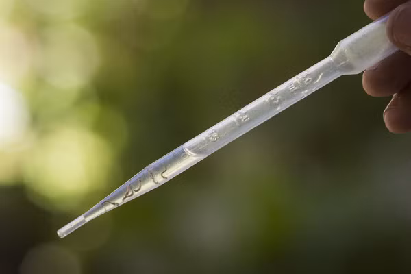 Để kiểm tra cơ thể có nhiễm Zika hay không, cần gửi mẫu máu hoặc mô từ tuần đầu tiên nhiễm virus tới các phòng thí nghiệm được trang bị đủ phương tiện, giúp phát hiện Zika thông qua các xét nghiệm phân tử phức tạp.