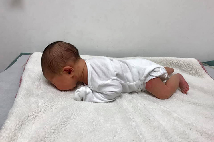 Hình ảnh con gái của Thân Thúy Hà được bác sĩ cho nằm sấp.