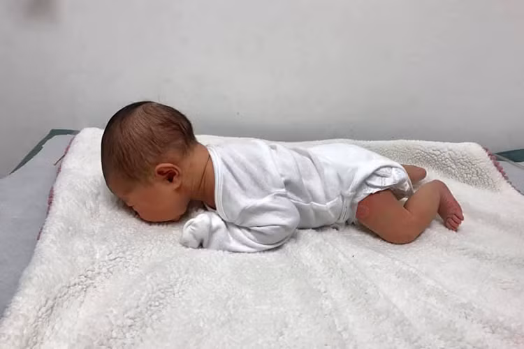 Hình ảnh con gái của Thân Thúy Hà được bác sĩ cho nằm sấp.