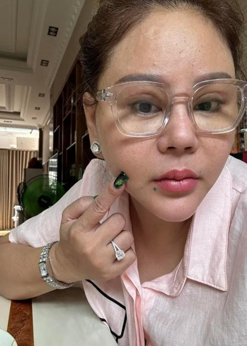 "Sáng nay nghe nhiều thông tin là Lê Giang tiêm filler bị méo mặt, dạ em không có chích, không có tiêm gì hết em vì sưng răng nhẹ không có méo ạ. Dạ em chụp không app nè", Lê Giang viết trên trang cá nhân. Ảnh: FBNV