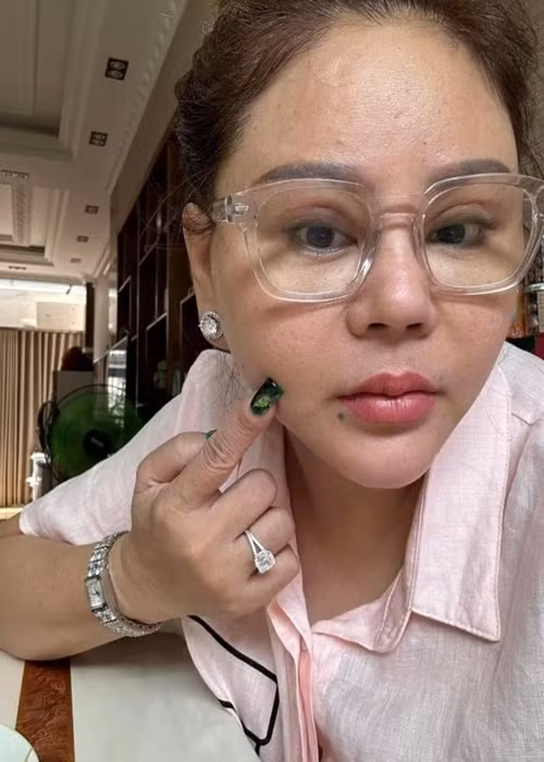 "Sáng nay nghe nhiều thông tin là Lê Giang tiêm filler bị méo mặt, dạ em không có chích, không có tiêm gì hết em vì sưng răng nhẹ không có méo ạ. Dạ em chụp không app nè", Lê Giang viết trên trang cá nhân. Ảnh: FBNV