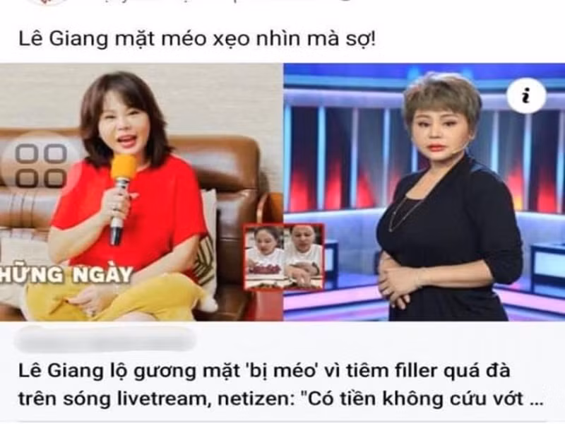 Mới đây, Lê Giang vướng nghi vấn tiêm filler quá đà. Nhanh chóng, nữ diễn viên hài lên tiếng phủ nhận. Ảnh: FBNV