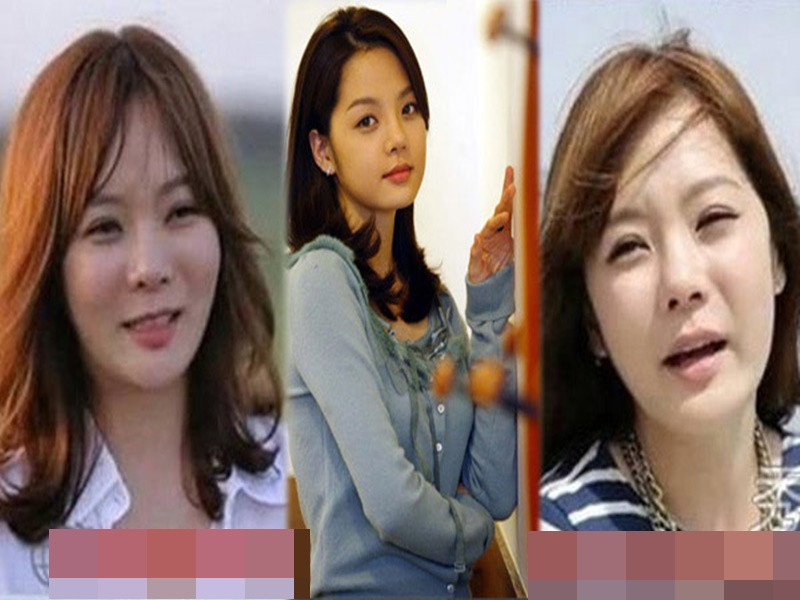 Chae Rim khẳng định cô không lạm dụng "dao kéo". Tuy nhiên, nữ diễn viên liên tục vướng tin đồn “nghiện” thẩm mỹ khi nụ cười gượng gạo và hai gò má căng phồng, cứng đơ. Vài năm trở lại đây, gương mặt của Chae Rim đã hài hòa hơn. Ảnh: Phunuonline