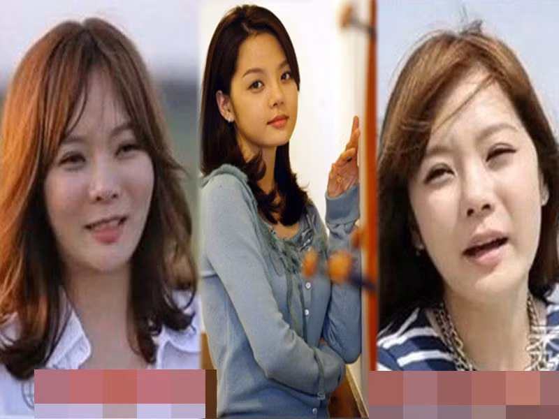 Chae Rim khẳng định cô không lạm dụng "dao kéo". Tuy nhiên, nữ diễn viên liên tục vướng tin đồn “nghiện” thẩm mỹ khi nụ cười gượng gạo và hai gò má căng phồng, cứng đơ. Vài năm trở lại đây, gương mặt của Chae Rim đã hài hòa hơn. Ảnh: Phunuonline