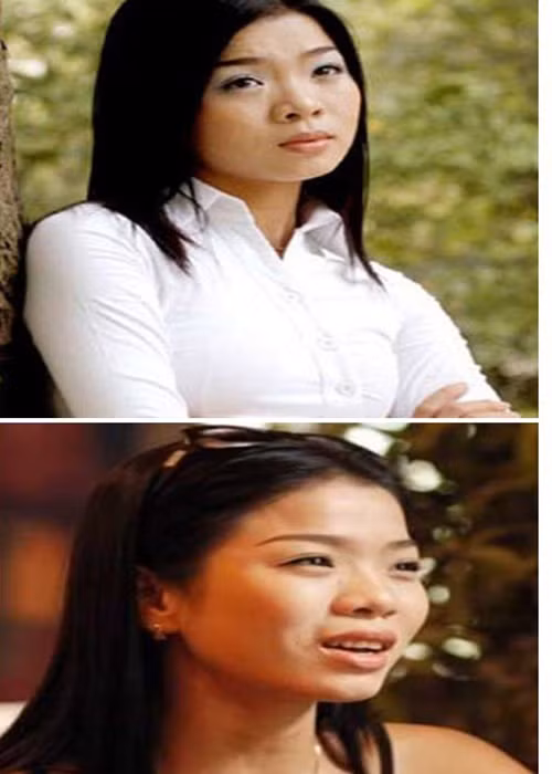 Nhan sắc Lệ Quyên thời chưa nâng mũi và sau 5 năm tháo sụn Nhan sac Le Quyen thoi chua nang mui va sau 5 nam thao sun
