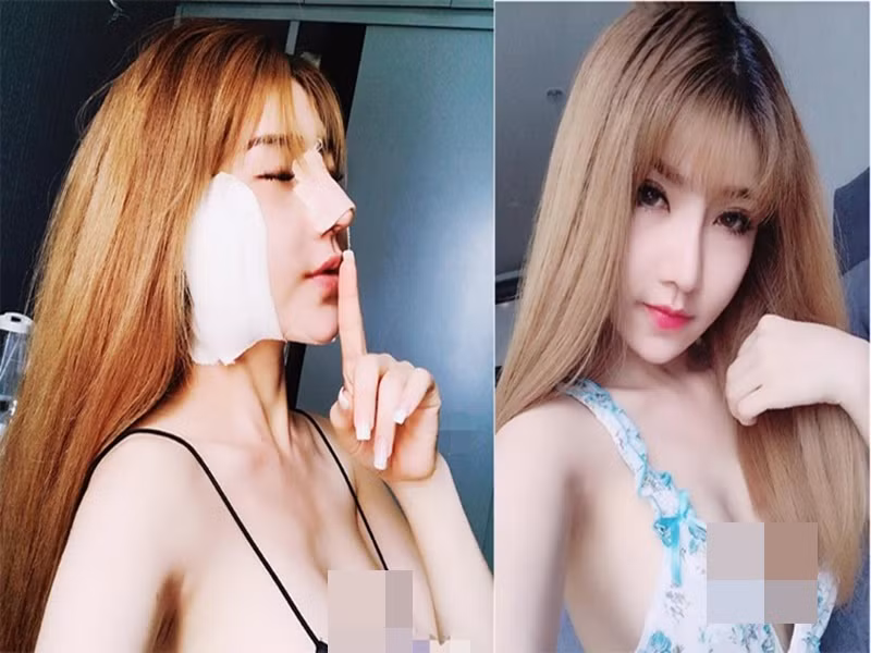 Hoàng Y Nhung dao kéo nhiều lần để gương mặt trở nên baby hơn. Ảnh: FBNV
