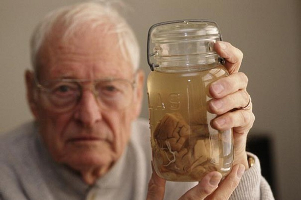 Harvey đã cẩn thận chụp ảnh bộ não của Einstein, đo đạc và cuối cùng cẩn thận cắt nó thành 240 mảnh, mỗi mảnh đều được đánh số để biết chúng ở bộ phận nào của não. Cuối cùng, những hình ảnh cũng như một phần bộ não của nhà vật lý tài danh đã được tặng lại cho viện bảo tàng.