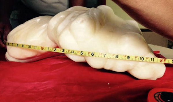 Anh cũng thừa nhận mình không nhận thức được ý nghĩa hoặc giá trị kếch xù của viên ngọc trai khổng lồ, cho đến khi anh đưa nó cho một hướng dẫn viên du lịch trên đảo Palawan, Gizmodo.