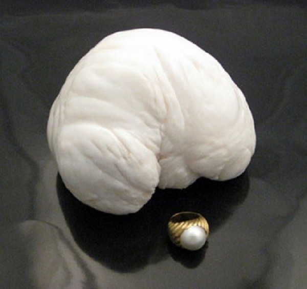 Ngọc trai được coi là báu vật, khái thác trong tự nhiên hoặc nuôi cấy để làm đồ trang sức. Trong Đông Y, nó còn được sử dụng làm thuốc do có tính bình, vị hơi ngọt, có tác dụng an thần, chữa kinh phong, giải độc, tan màn mây ở mắt, ù tai, chóng mặt …