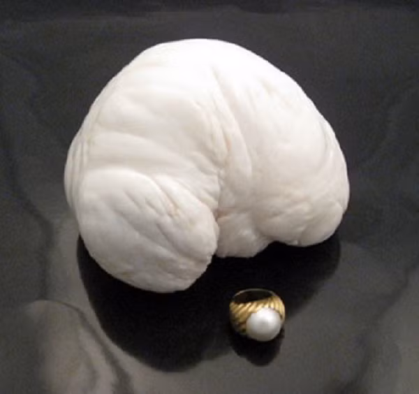 Ngọc trai được coi là báu vật, khái thác trong tự nhiên hoặc nuôi cấy để làm đồ trang sức. Trong Đông Y, nó còn được sử dụng làm thuốc do có tính bình, vị hơi ngọt, có tác dụng an thần, chữa kinh phong, giải độc, tan màn mây ở mắt, ù tai, chóng mặt …