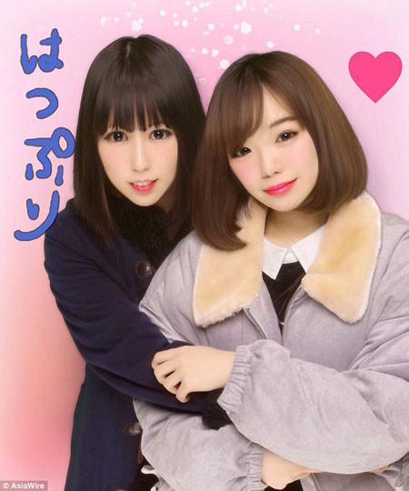 Cô gái trẻ (trái) hiện đã khỏe mạnh và xinh đẹp. Ảnh: AsiaWire