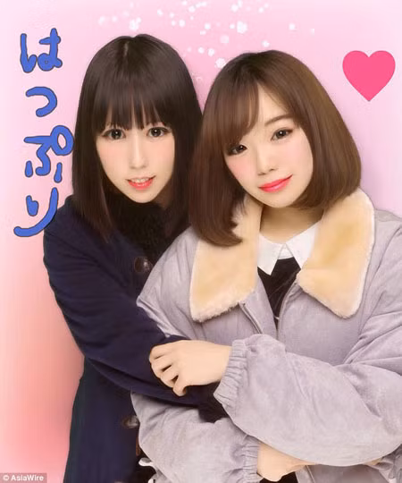 Cô gái trẻ (trái) hiện đã khỏe mạnh và xinh đẹp. Ảnh: AsiaWire