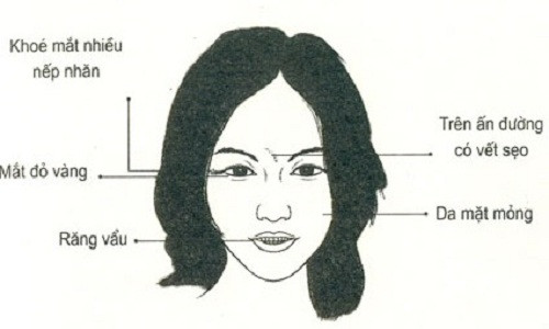 5 net tuong cua phu nu xau tu trong trung xau ra