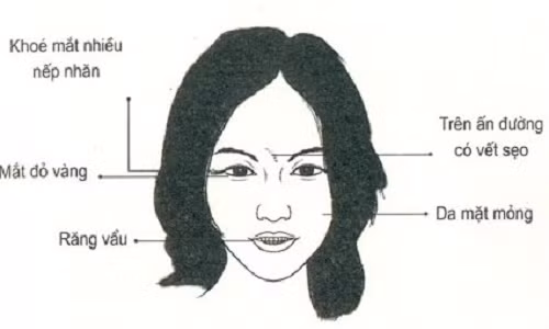 5 net tuong cua phu nu xau tu trong trung xau ra