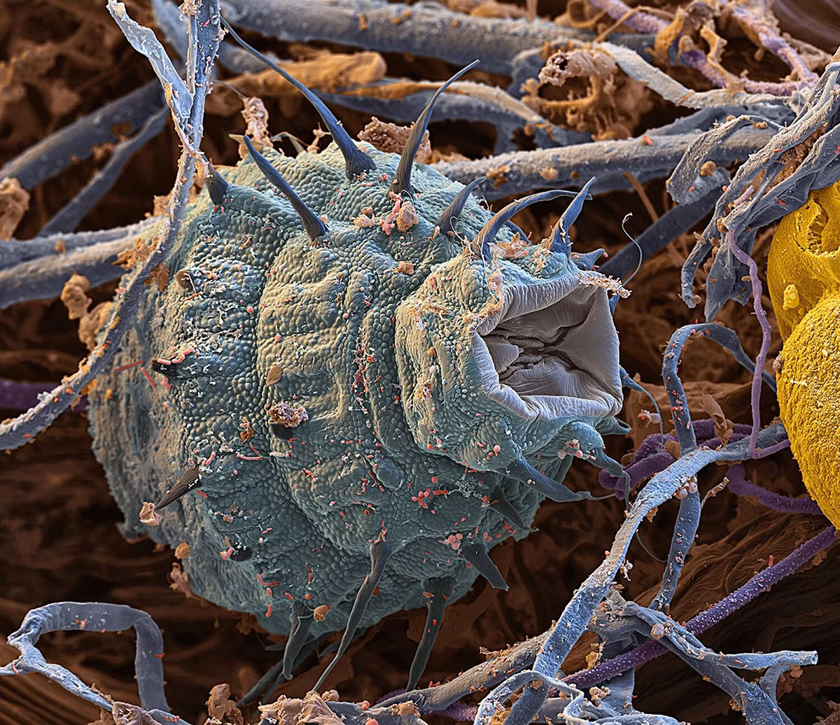 Hình ảnh các sợi nấm bao quanh một con luân trùng có gai, loài động vật cực nhỏ hiện diện phổ biến trong các hệ sinh thái nước ngọt.