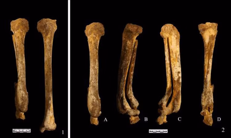 Hài cốt người phụ nữ cụt chân được tìm thấy trong chuyến khai quật từ năm 1999 nhưng không được nghiên cứu kỹ vì các nhà khảo cổ khi đó quan tâm hơn đến việc tìm kiếm hiện vật.