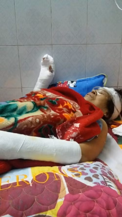 Nu sinh lop 8 sat hai hang xom roi tao hien truong gia-Hinh-2