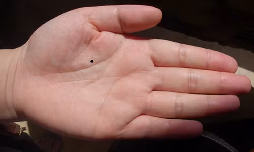 11 vi tri not ruoi o tay noi len dieu gi?