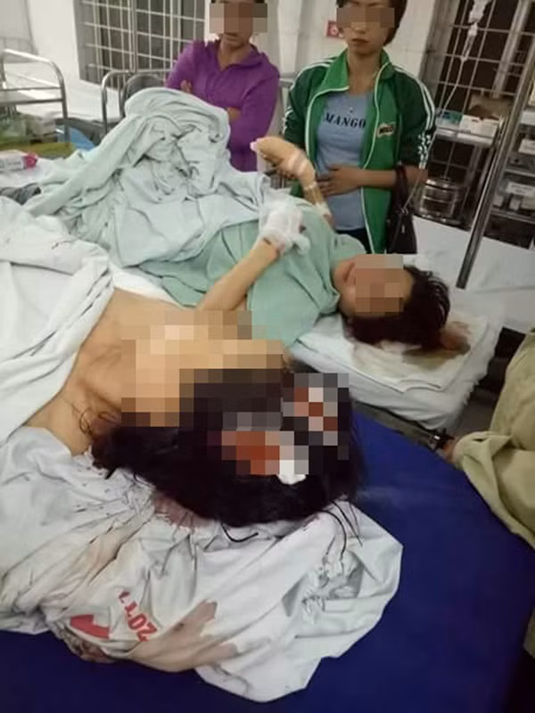 Mau thuan dat dai, thanh nien chem me va em gai nhap vien