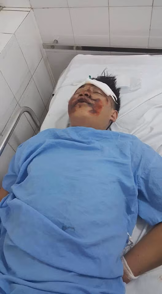 Cong an Ha Noi truy tim tai xe tong hai sinh vien chan thuong so nao-Hinh-2