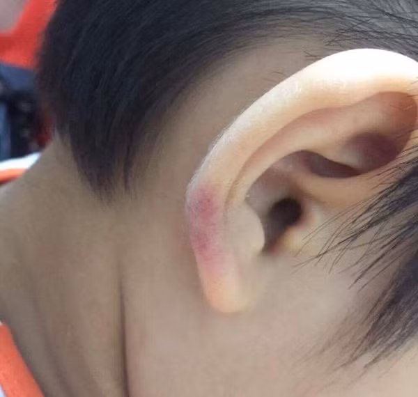 Be trai bi me ke bao hanh: Me de dau don ghi lai bang chung vu viec-Hinh-2