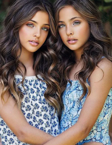 Sau 13 năm kể từ bắt đầu trở nên nổi tiếng, cuộc sống của cặp sinh đôi vẫn nhận được nhiều sự chú ý.