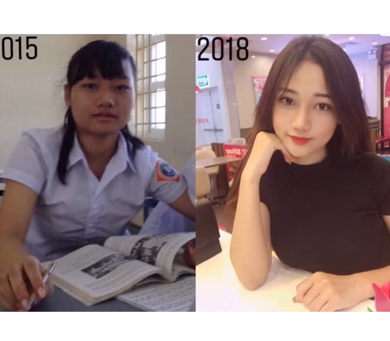 Vào năm 2018, hot girl Quảng Ninh từng “gây sốt” với màn biến hoá ngoại hình ngoạn mục. Từ một cô nàng có nhan sắc tầm trung, Dạ Thảo như hoá thành một người khác chỉ trong vòng 3 năm.