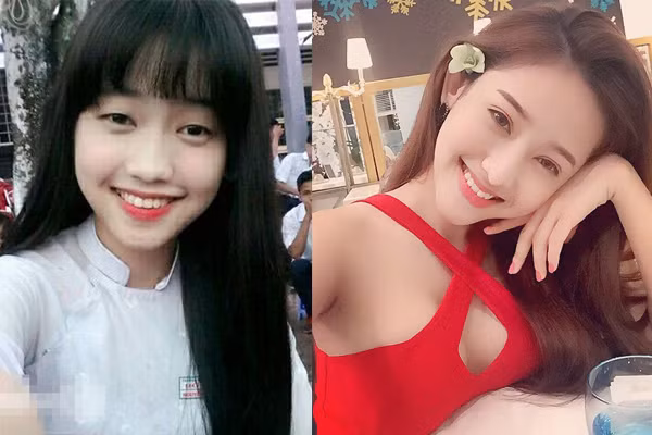 Thời điểm còn đang ngồi trên ghế nhà trường, Thúy Vi từng "gây sốt" khi công khai phẫu thuật thẩm mỹ vào năm 17 tuổi với hạng mục sửa mũi, nhấn mí. Những lần sau đó cô nàng còn can thiệp nhiều đến cơ thể để trở nên xinh đẹp hơn.