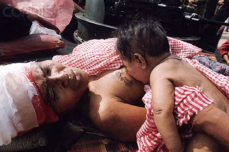 Một bà mẹ bị thương nặng vẫn cố gắng cho con bú.