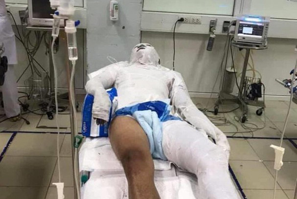 Do xang dot chay nguoi o Nghe An: Vi 2.5 trieu... thu doan ac on?