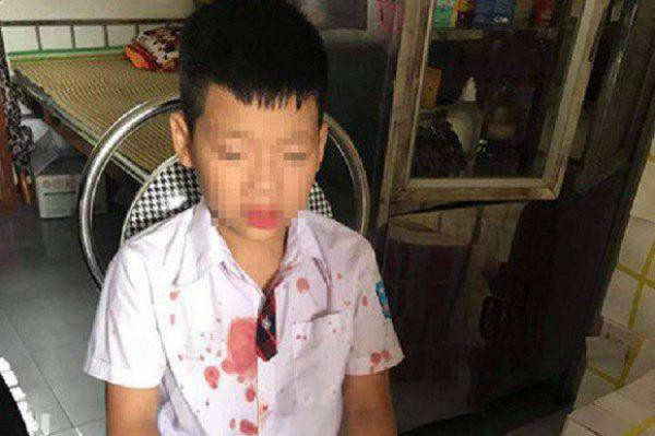  Khởi tố phụ huynh đưa bé lớp 1 ra ngoài trường hành hung: Ngày 16/7, Cơ quan CSĐT Công an TP Hòa Bình (tỉnh Hòa Bình) đã ra quyết định khởi tố vụ án, khởi tố bị can và tạm giam đối với Phạm Duy Đức (42 tuổi, ở phường Hữu Nghị, TP Hoà Bình) để điều tra về hành vi "Cố ý gây thương tích". Trước đó, chiều 10/7, khi học sin‌h N.G.K (học sinh lớp 1) đang đi vào cổng trường thì bị Phạm Duy Đức (SN 1978) - phụ huynh của em P.H.L (bạn cùng lớp N.G.K) đưa đến chỗ khuất để bạ‌o hàn‌h. Vụ việc khiến cháu K. bị chảy má‌u mũi, miệng.