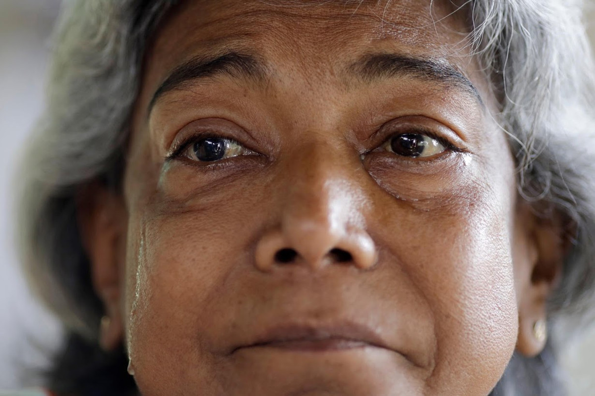 Venezuela mat dien, benh nhan chay than lam vao canh khon cung-Hinh-11