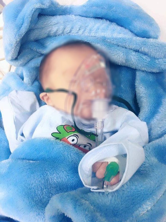 Cháu bé sinh ra sức khỏe rất yếu do không có điều kiện chăm sóc.