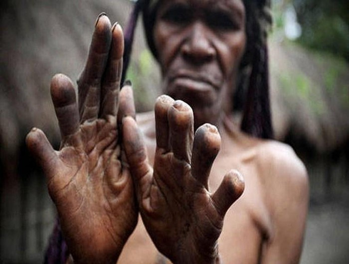 Dani là một bộ tộc sinh sống tại Indonesia. Họ khiến người ngoài tộc phải rùng mình vì khiếp sợ với nghi lễ cắt cụt ngón tay để bày tỏ sự thương tiếc người đã khuất