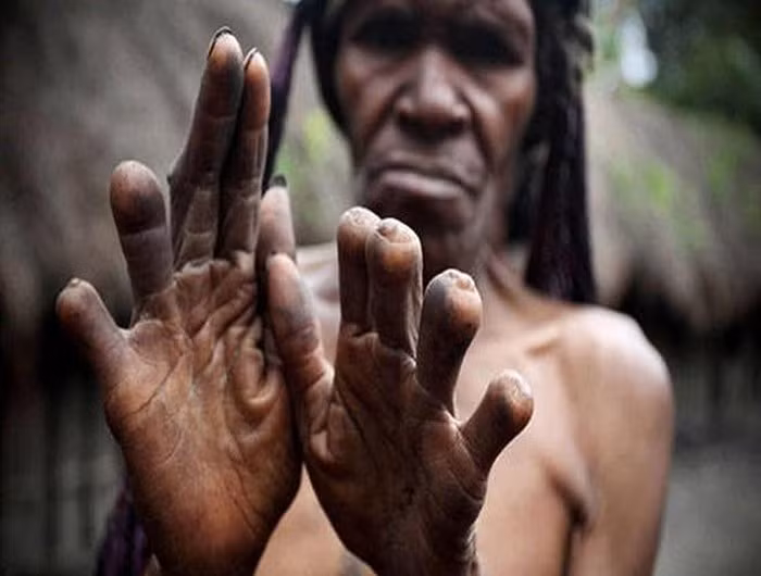 Dani là một bộ tộc sinh sống tại Indonesia. Họ khiến người ngoài tộc phải rùng mình vì khiếp sợ với nghi lễ cắt cụt ngón tay để bày tỏ sự thương tiếc người đã khuất