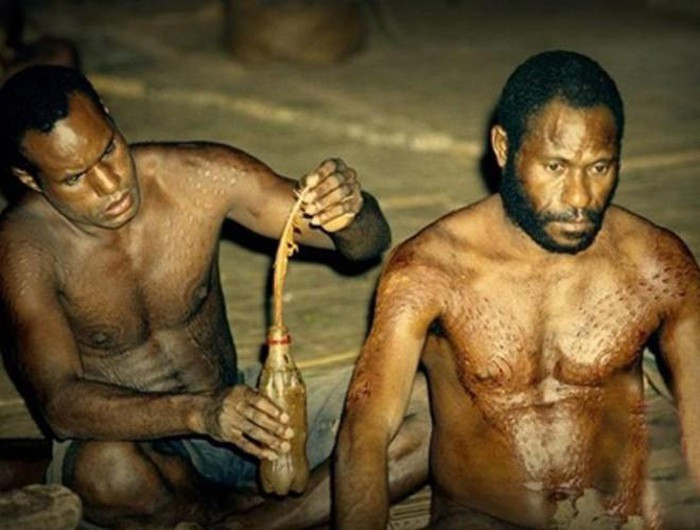 Để đánh dấu sự trưởng thành, các bộ tộc sống dọc sông Sepik ở Papua New Guinea sẽ tham gia một nghi lễ truyền thống - rạch cơ thể. Theo đó, các chàng trai sẽ lần lượt được trưởng tộc trong làng dùng dụng cụ được vót nhọn, rạch dọc sống lưng, ngực, mông để có làn da thô ráp giống những con cá sấu